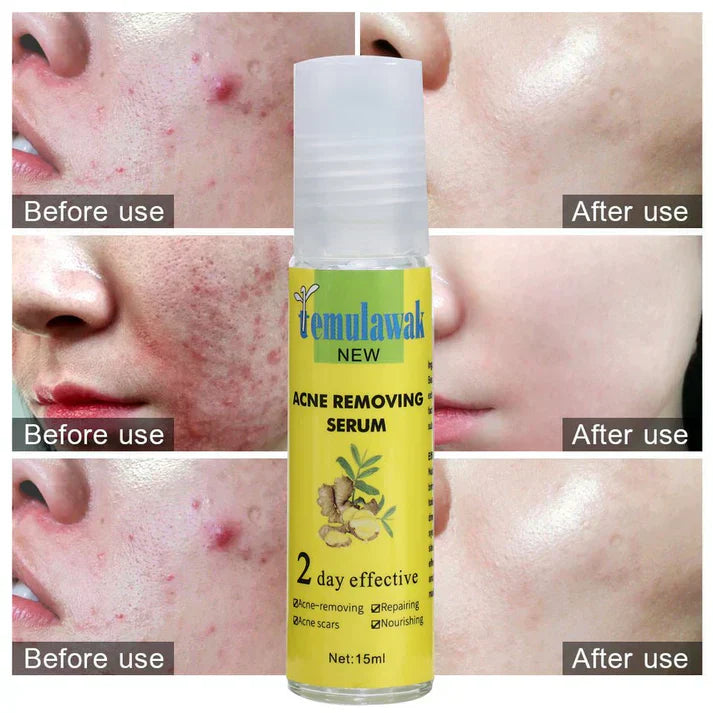 Temulawak - New Acne Removing Serum (Original)