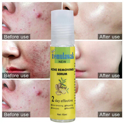 Temulawak - New Acne Removing Serum (Original)